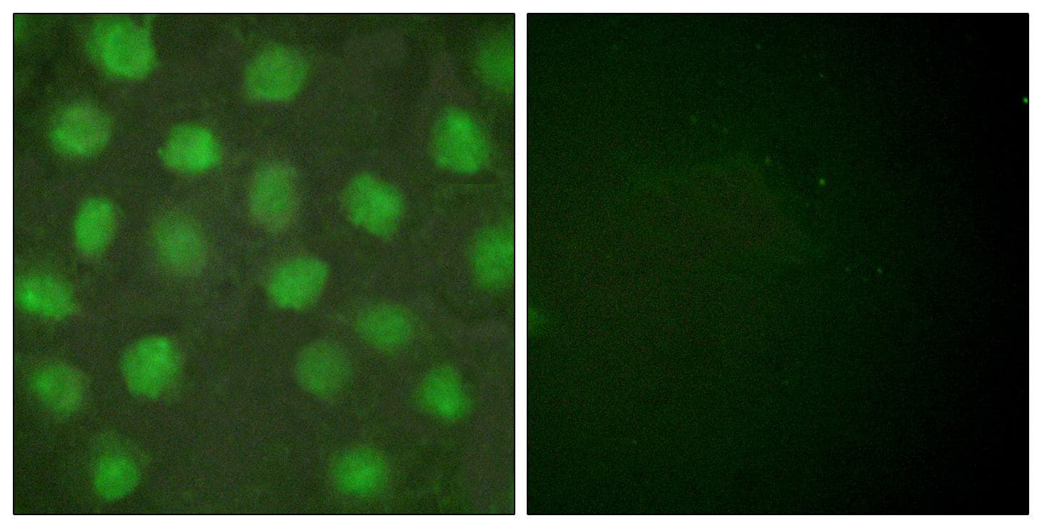 Polyclonal Rabbit anti-Human RXRG Antibody (IHC, IF, WB)