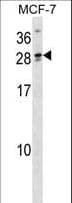 LIPT2 Antibody (aa13-43)