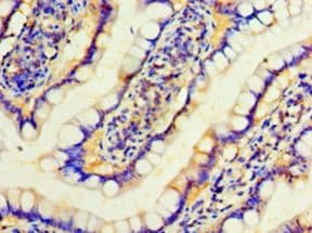 IFNA4 / Interferon Alpha 4 Antibody (aa24-189, Biotin)