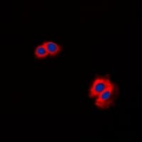 CARMA1 / CARD11 Antibody (N-Terminus)