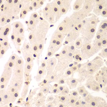 Polyclonal Rabbit anti-Human NIRF / UHRF2 Antibody (IHC, IF, WB)