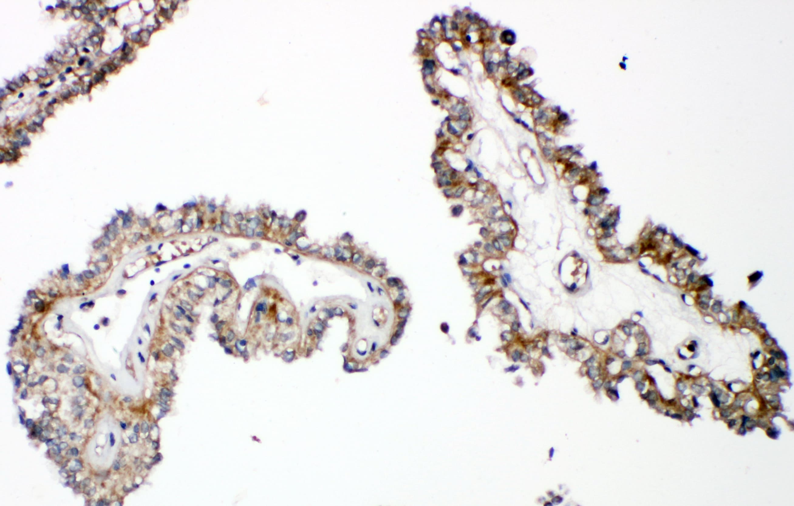 Polyclonal Rabbit anti-Human PTHR / PTHR1 Antibody (aa388-406, IHC, WB)