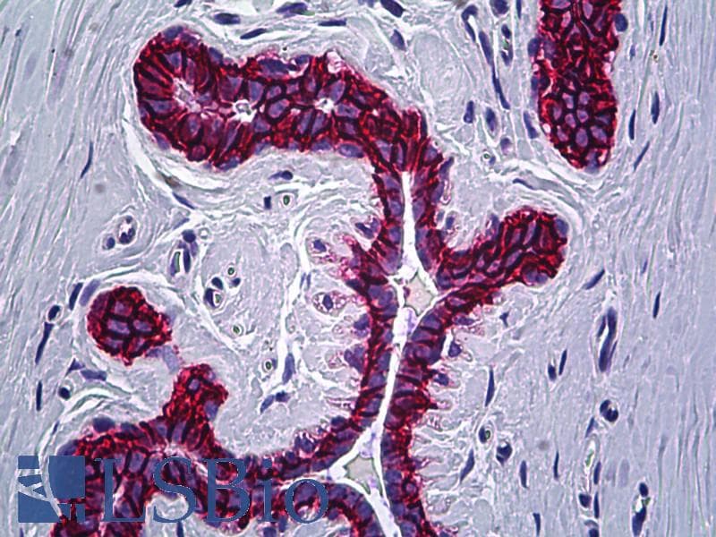 IHC-plus™ EPCAM Antibody (clone AUA1)