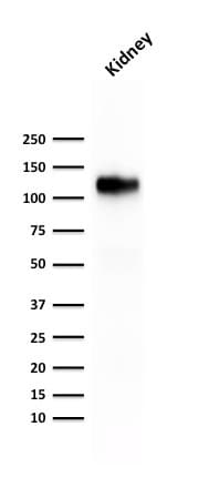 PathPlus™ Recombinant Monoclonal Mouse anti-Human CDH16 / Cadherin 16 Antibody (clone rCDH16/1071, IHC, WB)