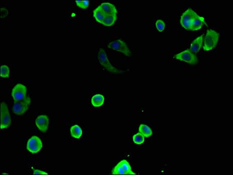 Polyclonal Rabbit anti-Human CCT8 Antibody (IHC, IF, WB)
