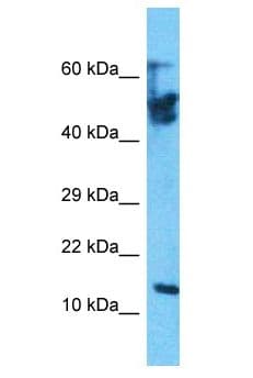 Polyclonal Rabbit anti-Human KLLN / KILLIN Antibody (aa81-130, WB)