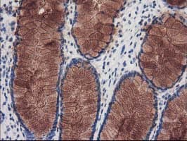 KATNB1 Antibody (clone OTI5C4, Carrier-free)