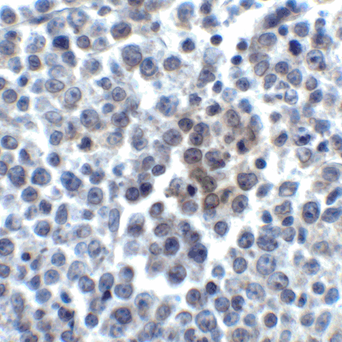 TNFSF14 / LIGHT Antibody (clone 8D4)