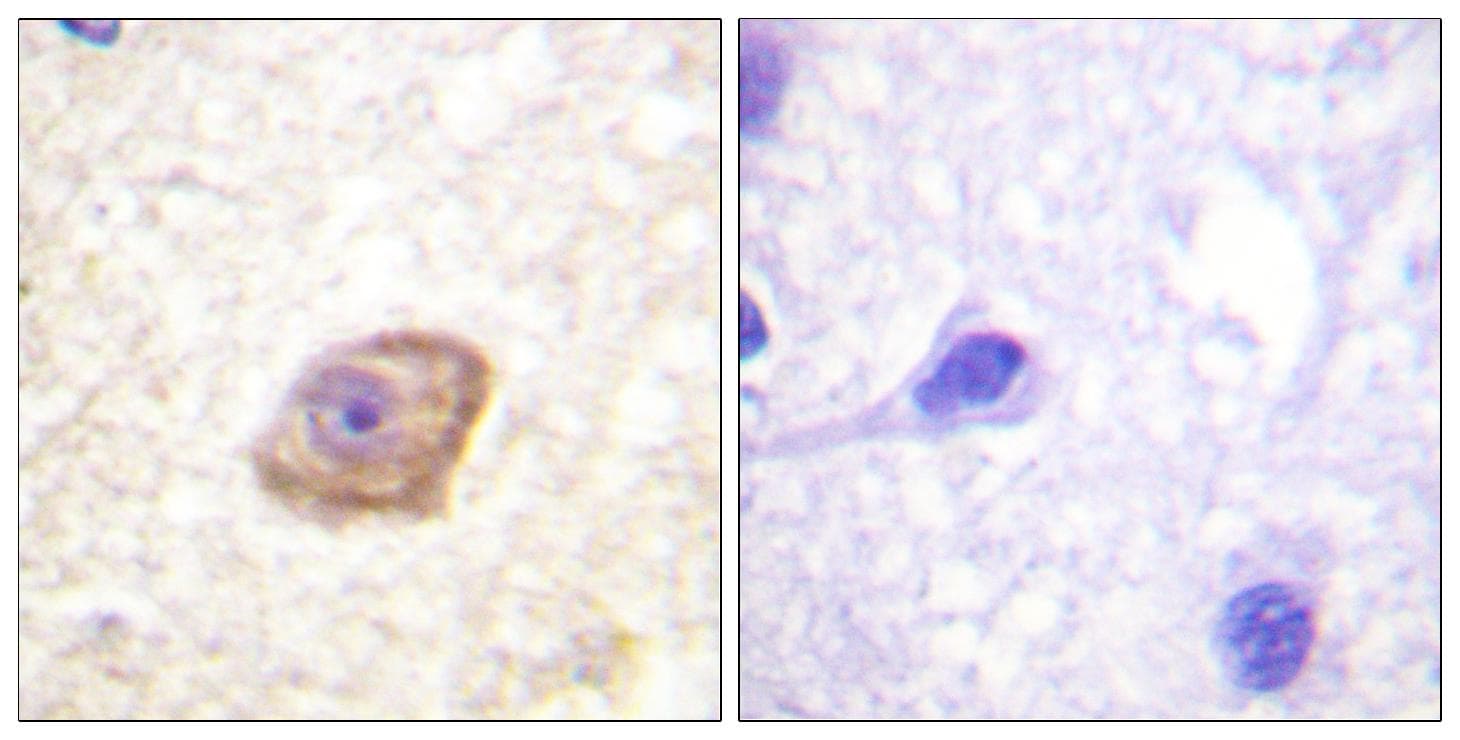 GRIN2B / NMDAR2B / NR2B Antibody (phospho-Tyr1474)