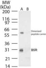 Smallpox-B5R Antibody (aa33-47)