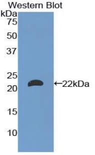 LAMA1 / Laminin Alpha 1 Antibody (aa2640-2773, FITC)