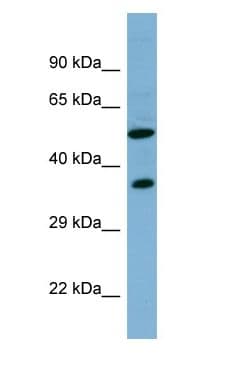 Polyclonal Rabbit anti-Human FDXR Antibody (aa137-186, WB)