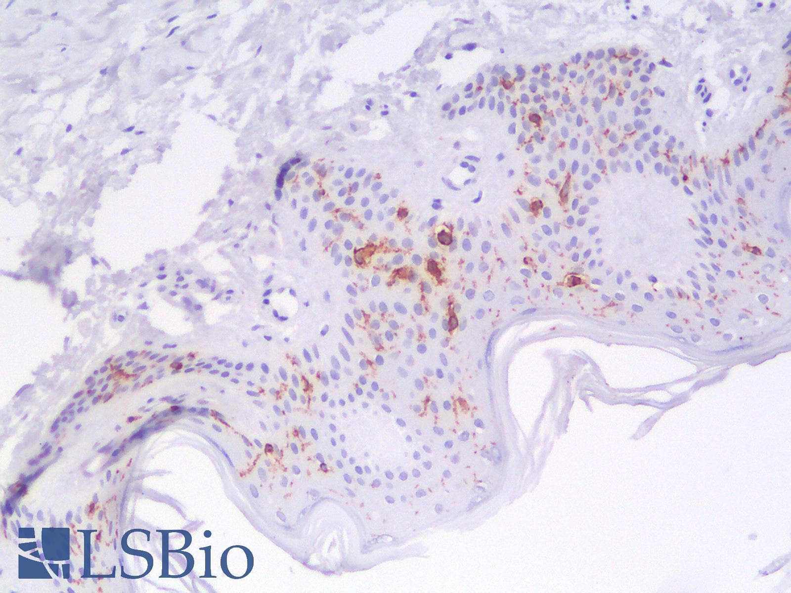 PathPlus™ CD1A Antibody (clone C1A/1506R)