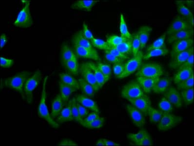 GUCY2D Antibody