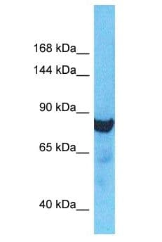 Polyclonal Rabbit anti-Human ZBBX Antibody (aa55-104, WB)