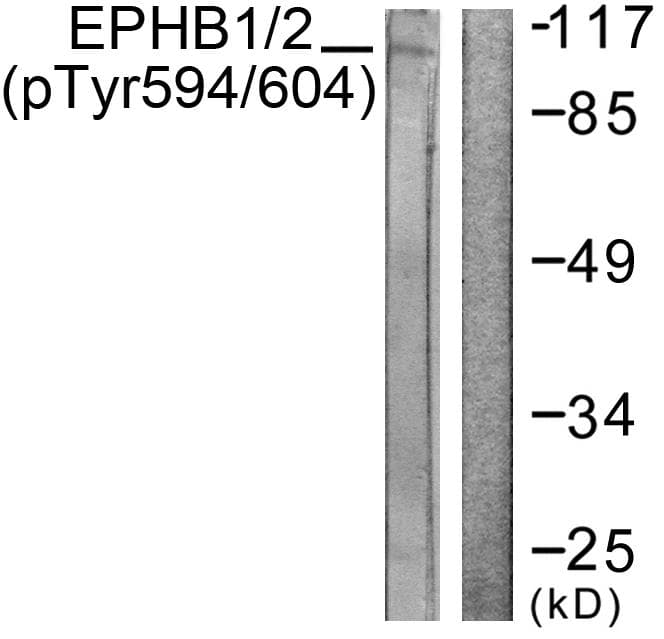 Ephrin B1+B2 Antibody (phospho-Tyr594/604)