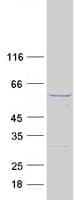 Human CCT8L2 Protein (Recombinant Myc-DDK (Flag))