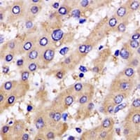 UCN2 / SRP Antibody