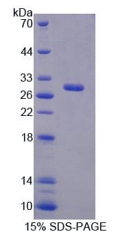Mouse RFC4 Protein (Recombinant His, N-Terminal)