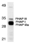 IHC-plus™ PHAP1 / ANP32A Antibody