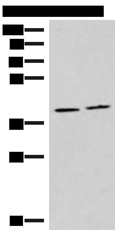 Polyclonal Rabbit anti-Human HMGCLL1 Antibody (IHC, WB)