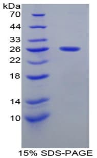 Mouse SMAD1 Protein (Recombinant His-T7)
