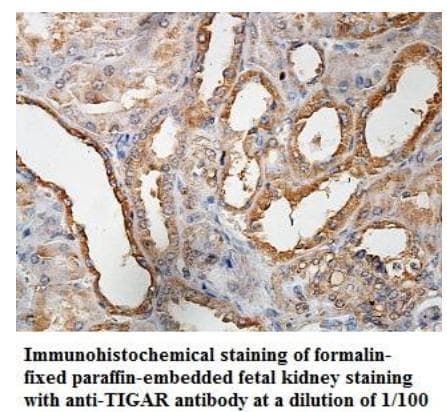 TIGAR Antibody (aa2-203)