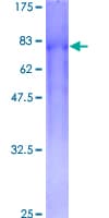 Human CSGALNACT2 Protein (Recombinant GST)