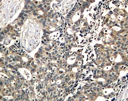 DOK2 Antibody (phospho-Tyr299)