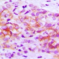 Polyclonal Rabbit anti-Human PCDHA12 Antibody (IHC, WB)