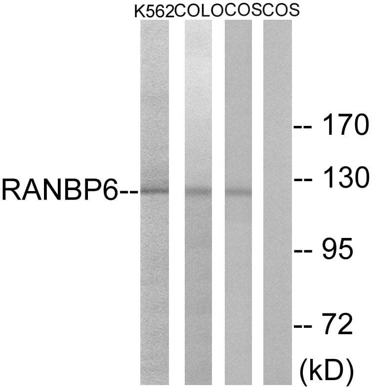 RANBP6 Antibody