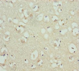 Polyclonal Rabbit anti-Human RDH12 / LCA3 Antibody (IHC)