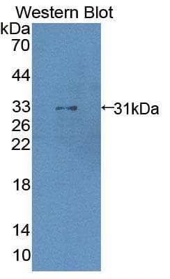 Polyclonal Rabbit anti-Human LDOC1 Antibody (aa1-146, WB)
