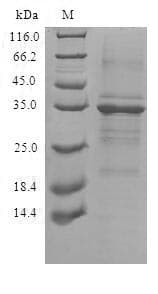 Human TMEM59 Protein (Recombinant 10His, C-terminus)