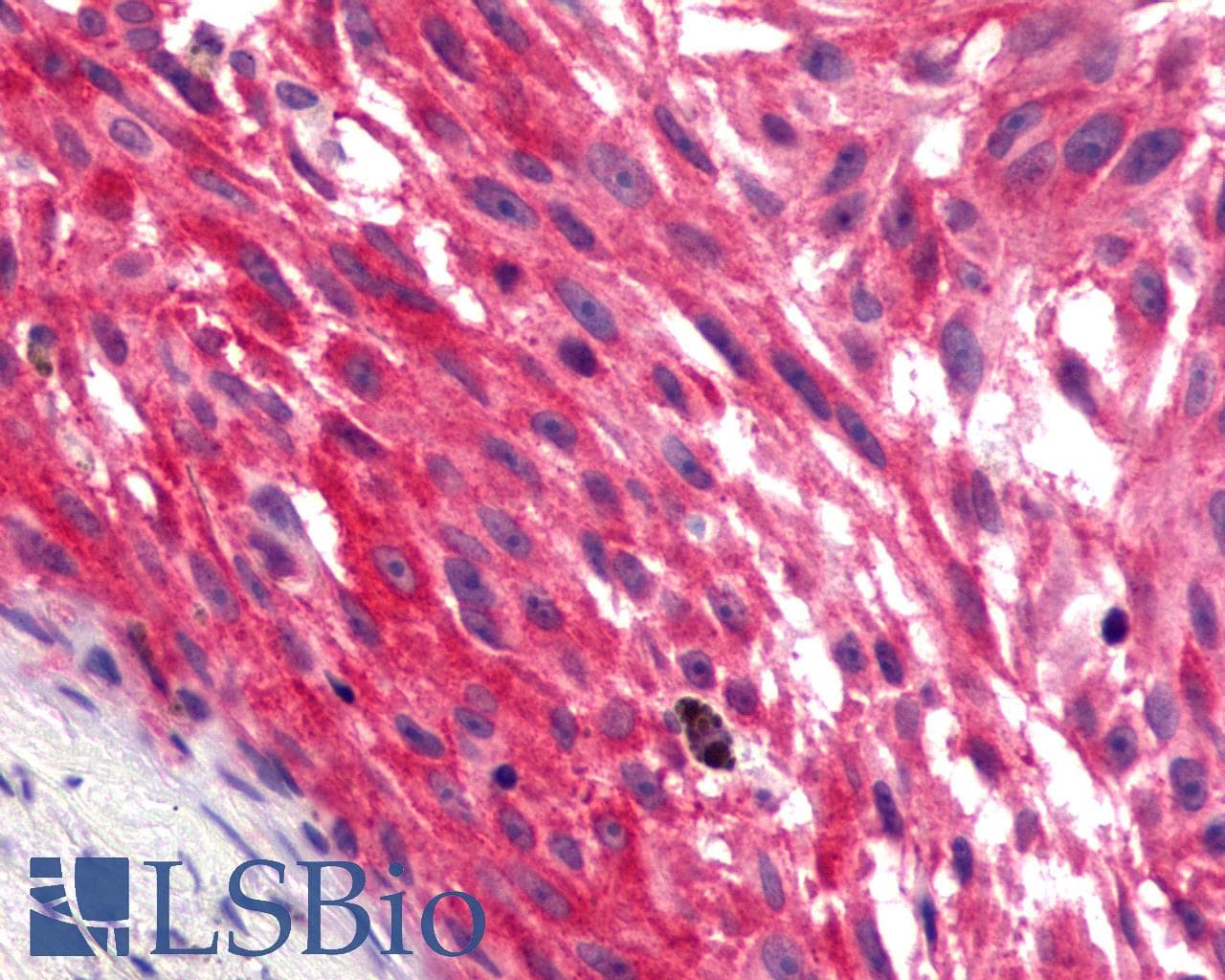 PathPlus™ Polyclonal Rabbit anti-Human GPR17 Antibody (N-Terminus, IHC)