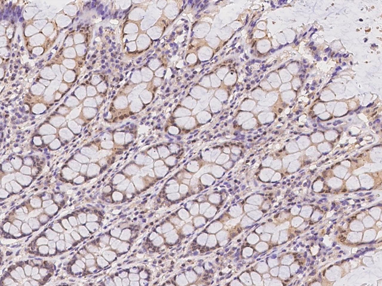 NLRP5 / NALP5 Antibody