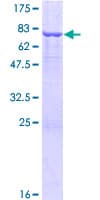 Human TUBA3D / Tubulin Alpha 3D Protein (Recombinant GST)