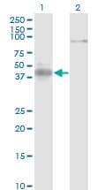 IHC-plus™ NEUROD1 Antibody (clone 3D11)