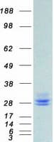 Human PRL / Prolactin Protein (Recombinant Myc-DDK (Flag))