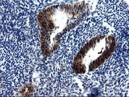CMPK / CMPK1 Antibody (clone OTI1H8)