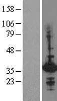 HHEX / HEX Protein (Over-Expression Lysate Myc-DDK (Flag))