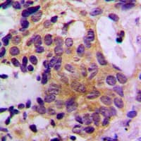 PTPN11 / SHP-2 / NS1 Antibody (C-Terminus)