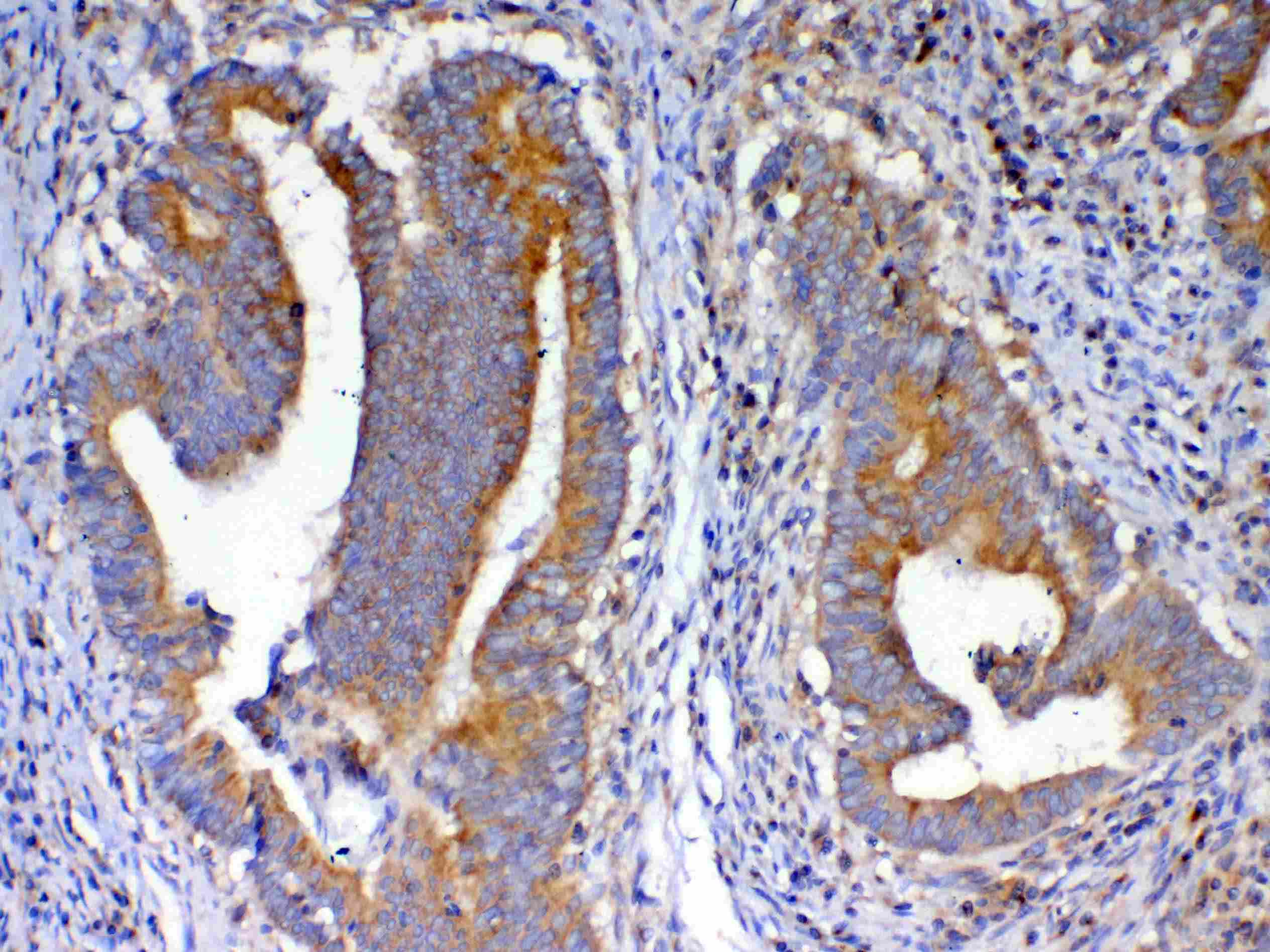 NSF Antibody