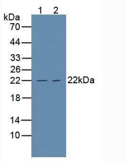 TNFRSF1A / TNFR1 Antibody (aa248-428)