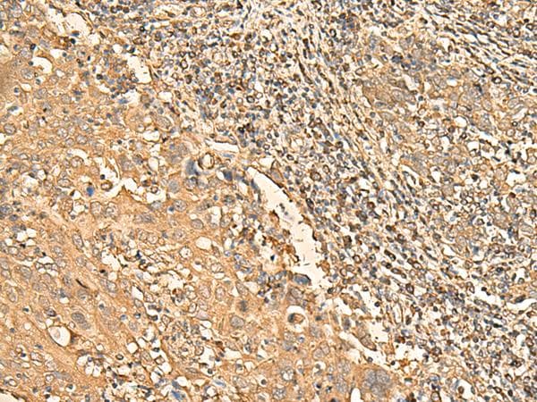 RPS28 / Ribosomal Protein S28 Antibody