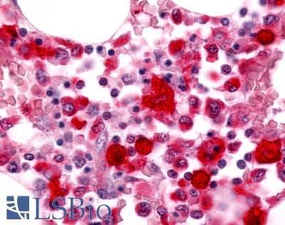 PathPlus™ MST1R / RON Antibody (C-Terminus)