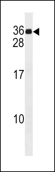 GAJ / MND1 Antibody (aa174-200)