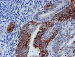 CYB5R1 Antibody (clone OTI4B7)