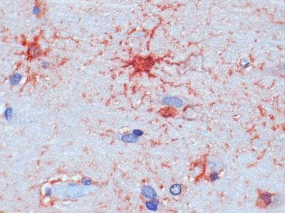 Monoclonal Mouse anti-Human GPR19 Antibody (clone 1B5, IHC)
