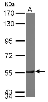 PGM3 Antibody (aa44-321)